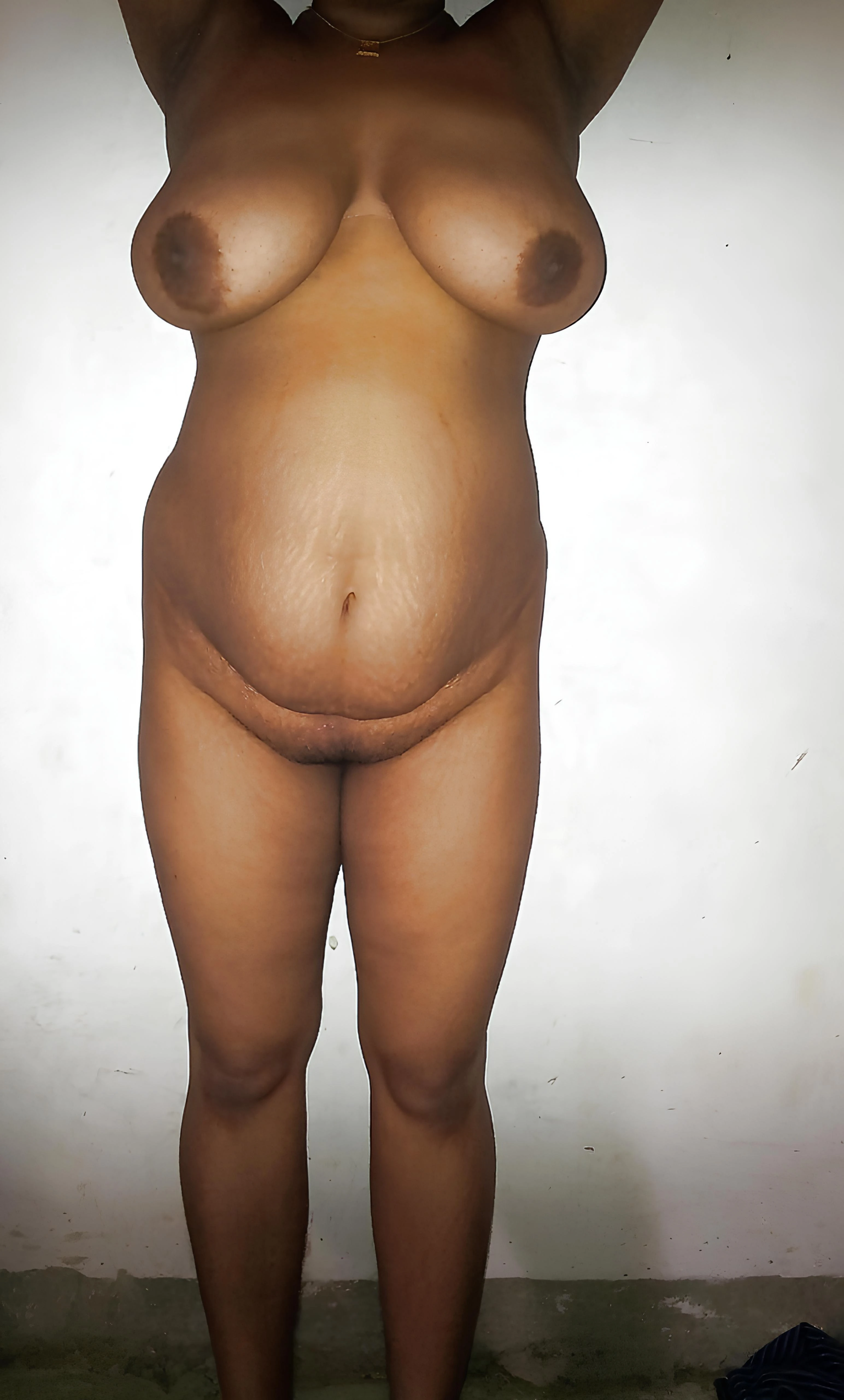 Nude Desi woman stands with her arms raised, displaying her full breasts and stretch marks, with a patch of trimmed pubic hair